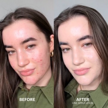 Cicapair tiger grass color correcting treatment before  after